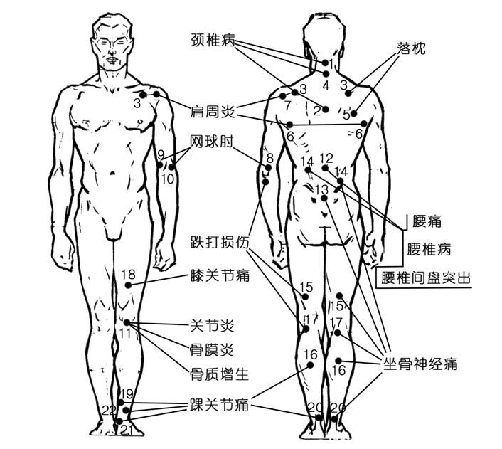 上海市远红外线颈椎治疗仪厂家供应远红外线颈椎治疗仪 立式YHL-III型神灯治疗仪