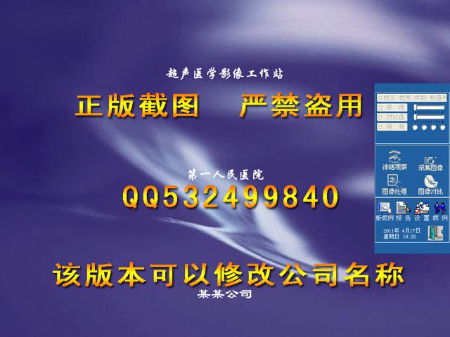 供应超声工作站三维超声随心所欲XP版