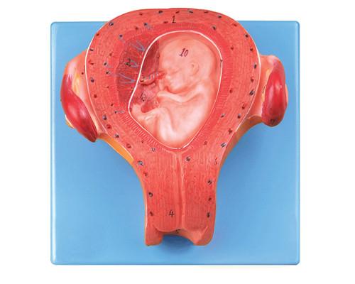 三个月胚胎模型-上海怡健医学