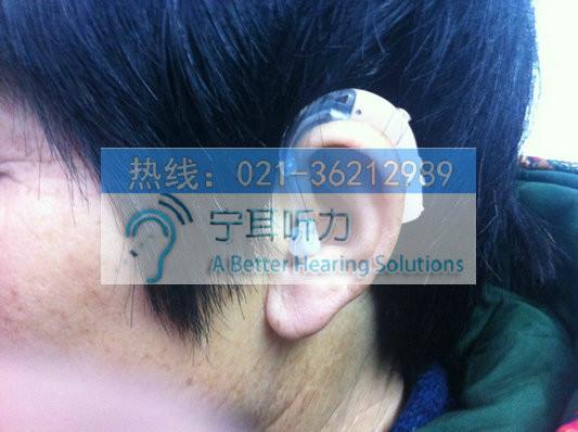 上海市上海哪有卖助听器的厂家