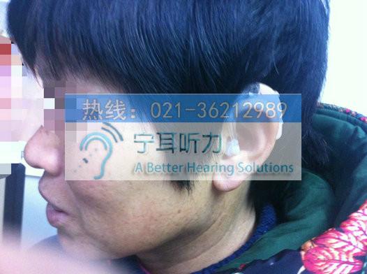 供应上海哪有卖助听器的/闸北中山北路198号折扣特价店品牌特惠5折起